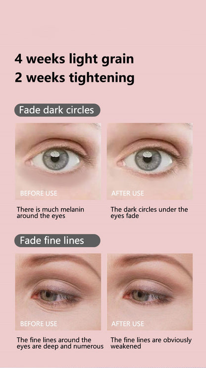 4-in-1 Red Light Therapy Wand